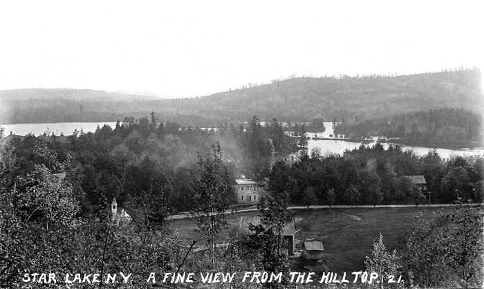 StarLakefromHill